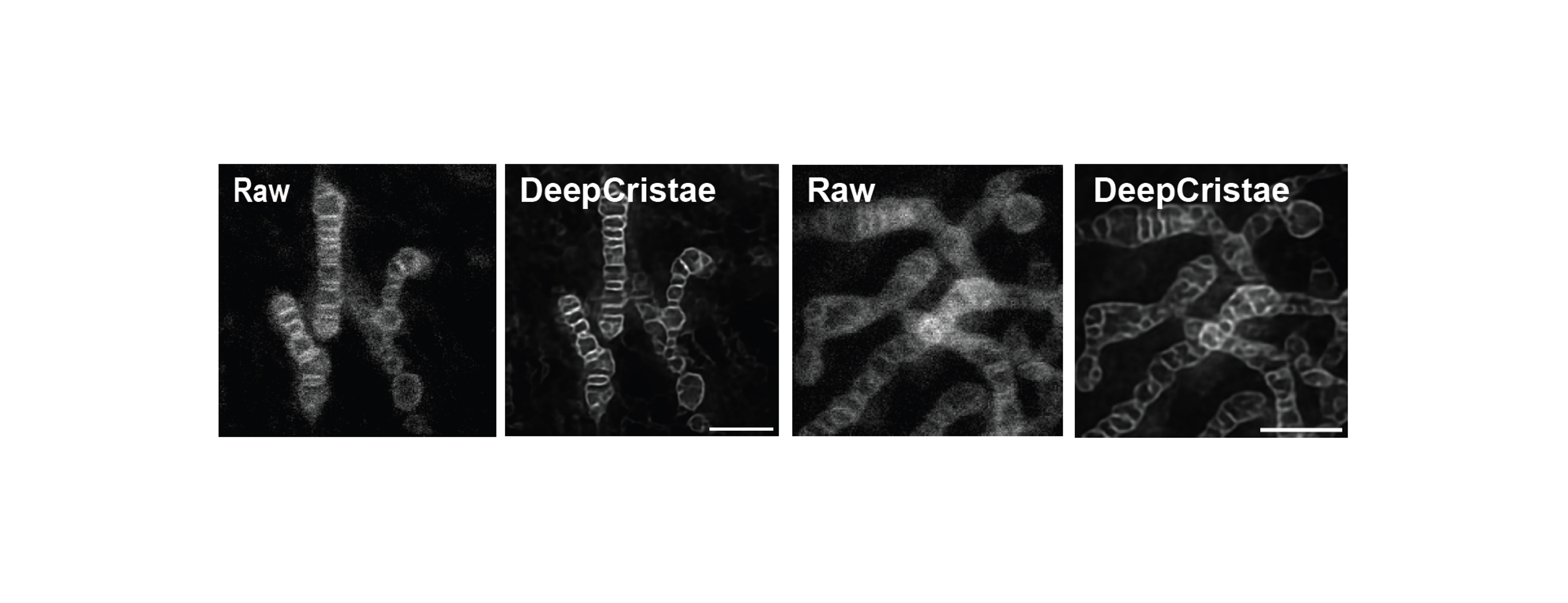 Illustration for DeepCristae in Communications Biology.